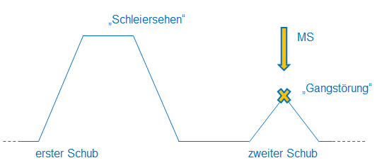 MS Diagnose Poser Kriterien